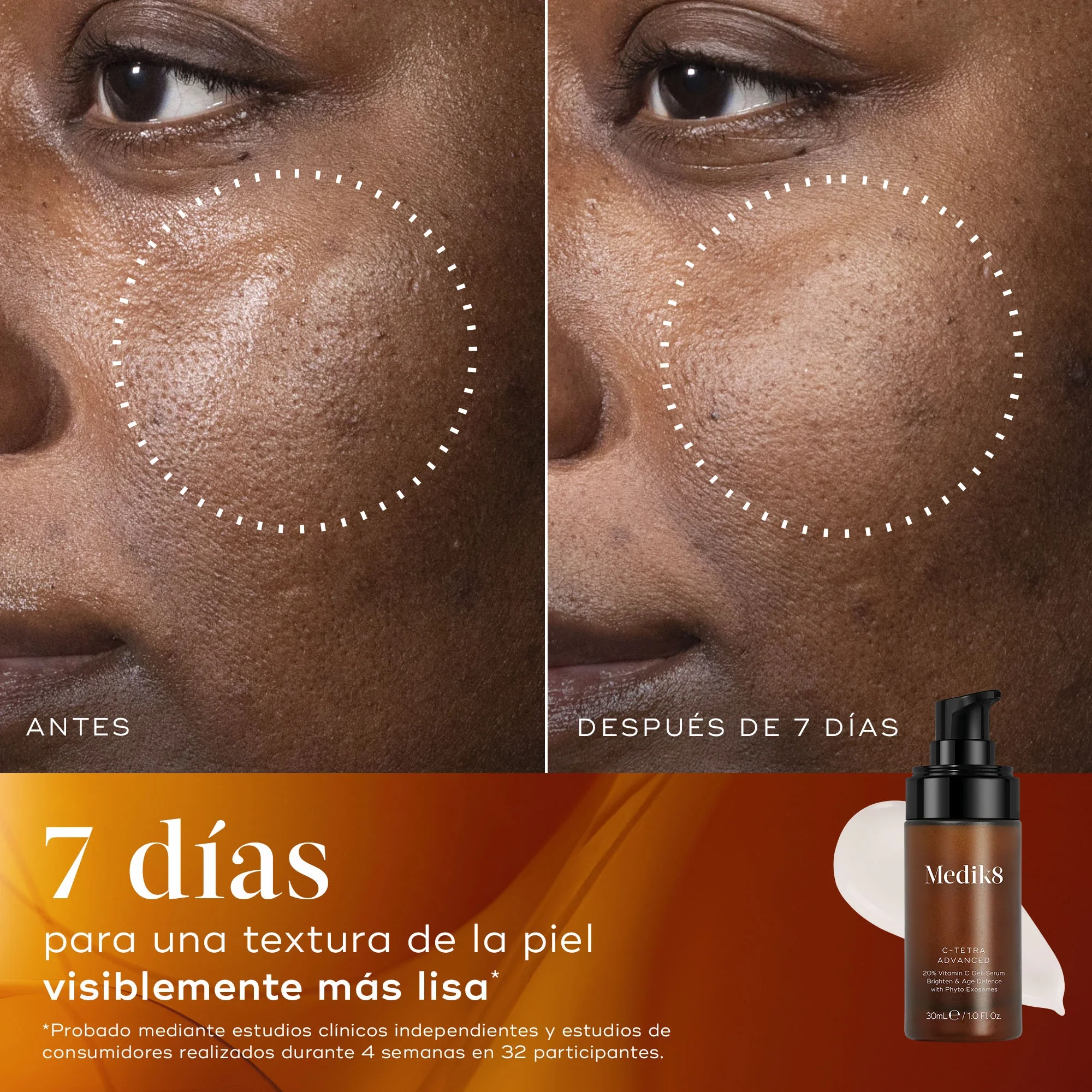 C-Tetra® Advanced - Image 3