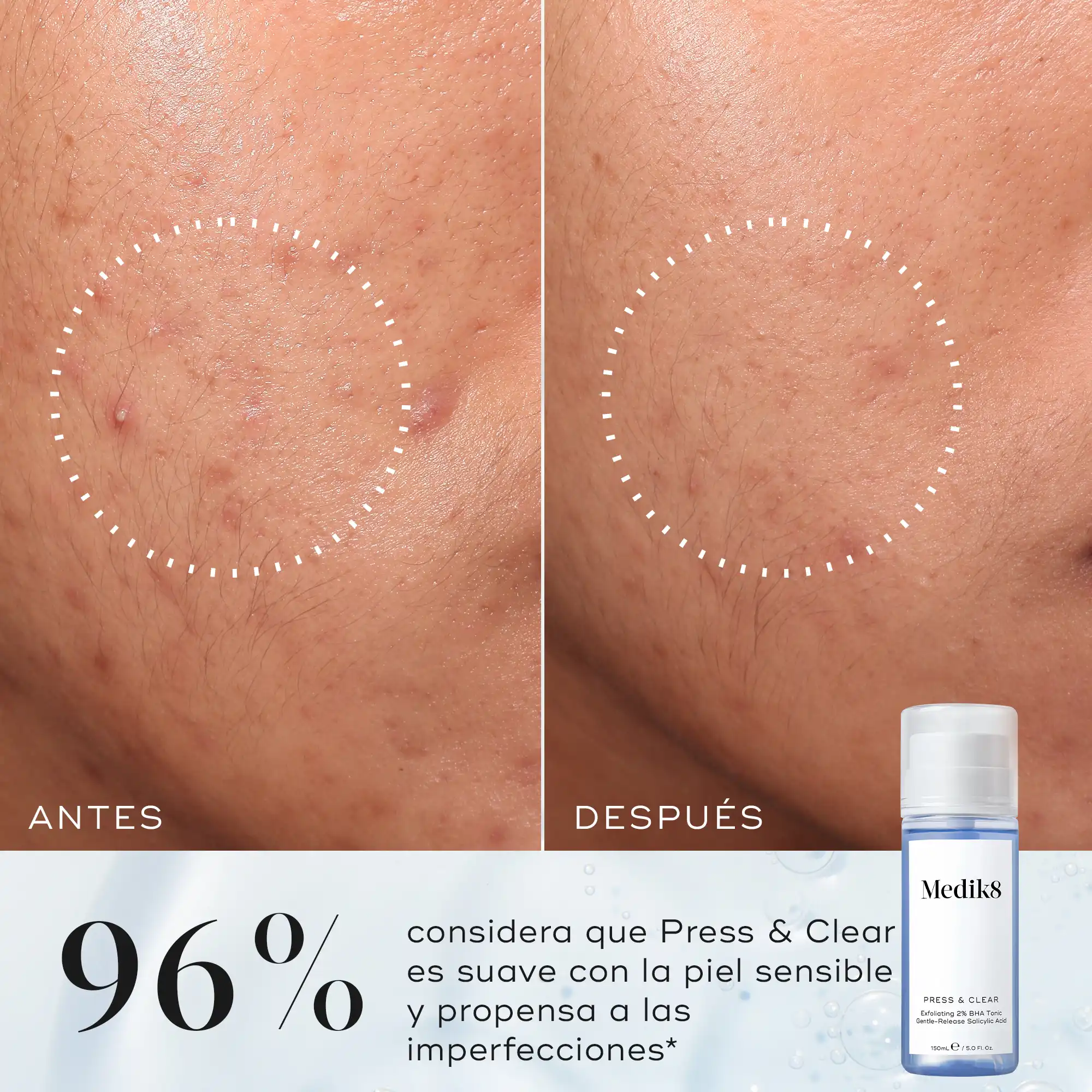 Press & Clear™ - Image 3