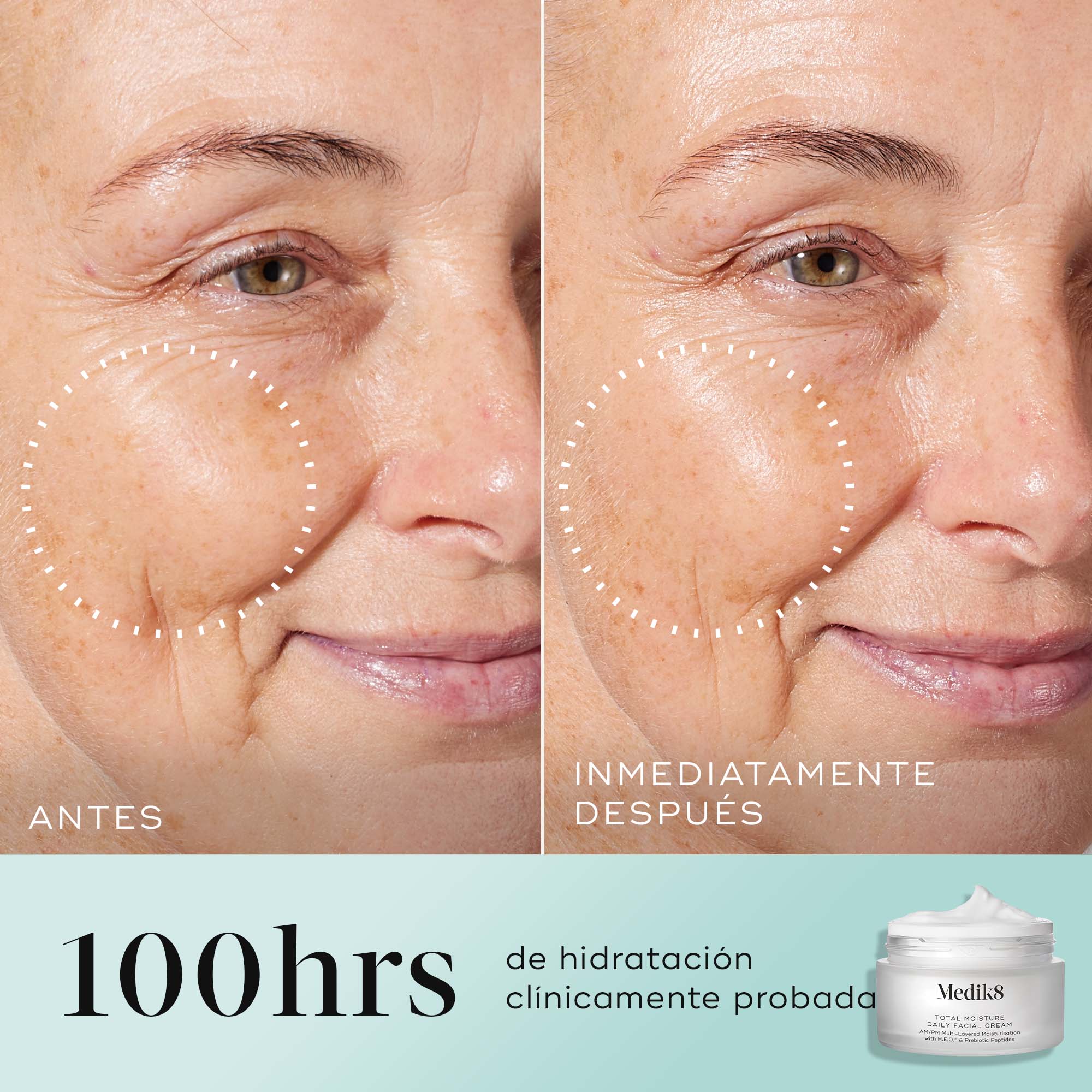 Total Moisture Daily Facial Cream Refill - Image 4